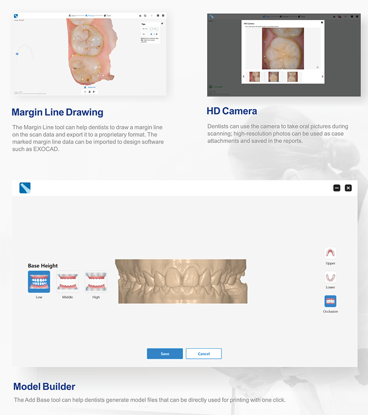 IOS33 Intraoral Scanner